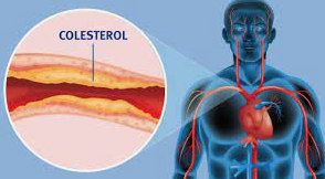 Colesterol